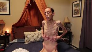 Gross Anorexic Porn - Anorexic Muse J 19-09-2022
