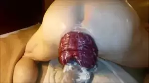anal prolapse cum - Cumming on and in a Prolapse | xHamster