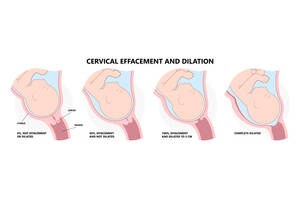 dialated pregnant wifes pussy - Cervix Dilation Chart: Signs, Stages And Procedure To Check