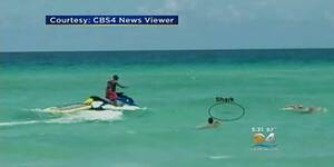 haulover beach nude - Naked swimmer bitten by shark at Florida beach