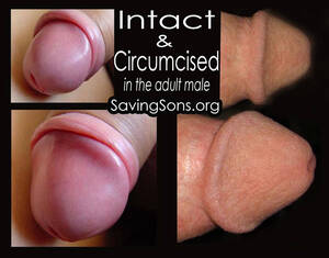 Circumcised - peaceful parenting: Intact or Circumcised: A Significant Difference in the  Adult Penis
