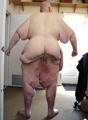 Fattest Porn Star - PHOTOS: Former world's fattest man poses naked â€“ JeniesGiovanni.com