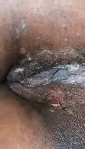 black std pussy - Cute ebony explored while sleep, guy finds STD'd pussy - ThisVid.com