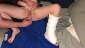 Broken Foot Porn - Nursing My Wife's Broken Leg Back To Good Health Through Her Vagina | free  xxx mobile videos - 16honeys.com
