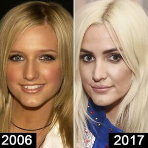 Ashlee Simpson Cum - Did Ashlee Simpson Get More Plastic Surgery? Experts Say Yes!