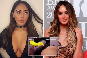 Katy Perry Anal - Anal bleaching soars by 23% as women copy Geordie Shore's Sophie Kasaei,  Charlotte Crosby and Kourtney Kardashian | The Sun