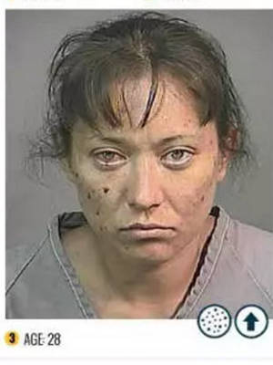 Meth Face - Meth user after