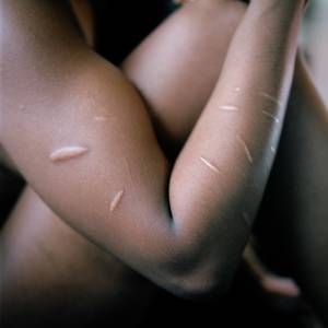 Blooming Youth - They're memories of her youth, even though she describes her childhood as  happy. Photo: Margareta Bloom SandebÃ¤ck / Kontinent ...