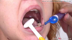 Mouth Dental - MOUTH FETISH VIDEO - ALEX GET DENTAL AND MOUTH EXAMINATION FROM SARAH -  XVIDEOS.COM