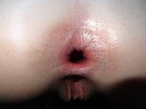 Amateur Gape - Amateur gape Porn Pic - EPORNER