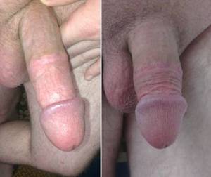 circumcised hand job - So I was delighted to see another doctor. She was a woman. This doctor  looked at the medical history and she asked me what I know about  circumcision and ...