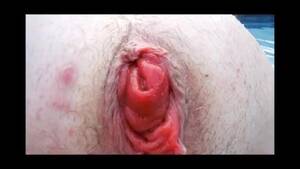 bbw anal prolapse - Multiorgasmic BBW Anal Prolapse Play- Eating anal prolapse Porn Videos -  Tube8