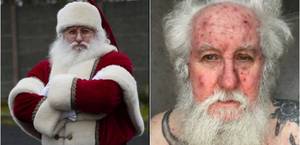 Christmas African American Porn - Santa Claus Gets Chicken pox