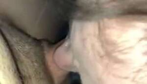 Acne Ass Lesbians - Acne Face Fuck - Tnaflix.com, page=2
