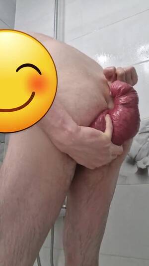 Biggest Anal - Biggest Anal Prolapse #1