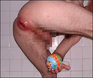 big butt anal sex bleeding - Maybe eight or ten times I've had blood, but it was mostly because I didn't  use enough lubricant.