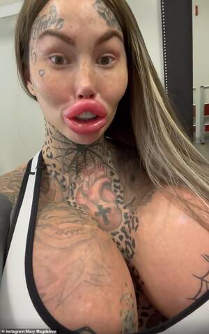 Botox Lips Porn - Surgery-addicted social media star can't close her mouth after lip fillers  | Daily Mail Online