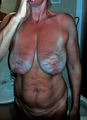 big bruised tits boobs - Beautiful big bruised boobs | MOTHERLESS.COM â„¢