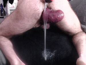 longest anal prolapse - PROLAPSE GALLERY #1 - HungerFF.com