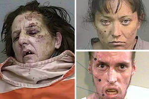 Meth Face Porn - Crystal meth users after years of abuse