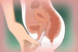 extreme uterus insertion hentai - Forced Cervix Penetration Hentai X Ray