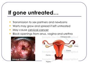 infection from anal sex - Hot and sexy lesbian porn