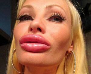 Huge Lips Porn - Enormous 'porn star lips' on show in terrifying gallery of selfies | The Sun
