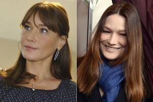 Before After Porn Stars Who Got Fat - Stars who had plastic surgery â€¦ or didn't â€“ New York Daily News