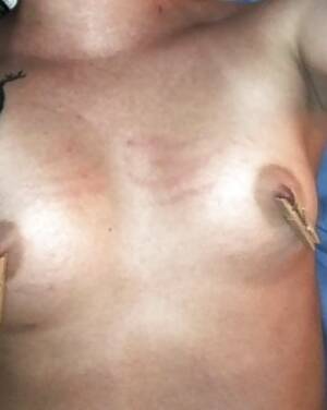nipple torture galleries - Nipple torture Porn Pictures, XXX Photos, Sex Images #1727924 - PICTOA