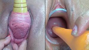 Cervix Fuck Porn - Lesbians Pee Hole Penetration and Cervix Fucking - ThisVid.com
