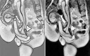 Mri Porn - The least sexy porn ever