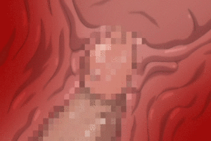 extreme uterus insertion hentai - Forced Cervix Penetration Hentai X Ray