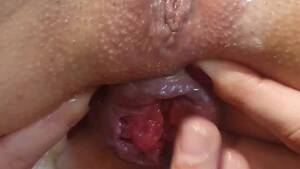 her first anal prolapse - First prolapse of my ass Anal fisting that makes me squirt Anal fingering  Red rose of my asshole - RedTube