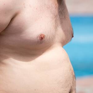 big fat ugly nipples - Gynecomastia vs. Chest Fat: What Are the Causes and How Do I Treat Each?