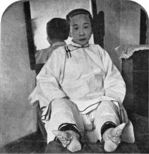 Chinese Porn From The 1800s - A Chinese lady whose feet were bound from childhood. Late 1800s. [937x967]  : r/HistoryPorn