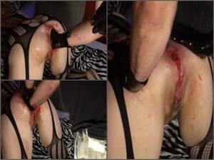 fisting her ass bleeding - Dirty Anal Gape | Amateur Fisting - New Rising Pornstar LanaFist 1st Video  With Bloody Fisting â€“ Premium User Request