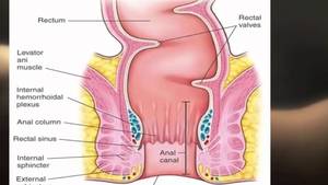 anal sex issues - Anal Sex Safety and Health Concerns