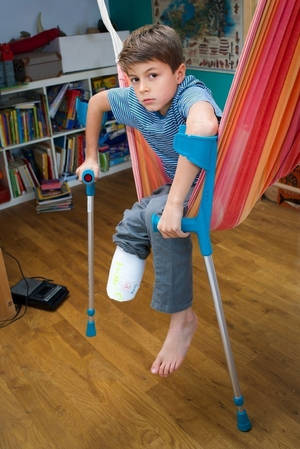 Empty Sleeve Amputee Porn - Recent foot amputee Tomaz