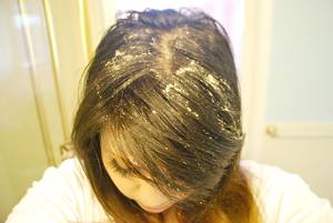 Greasy Hair Oily Messy Porn - 