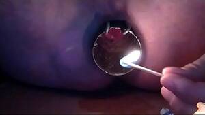 extreme anal mutilation - anal torture porn - extreme anal torture sex - Darknessporn.com