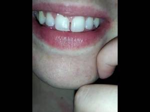 Asian Mouth Fetish Porn - Teeth Fetish Talk