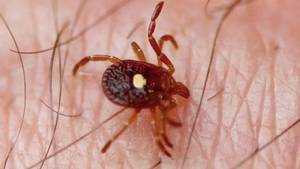 cute braces cum shot 2 - How one bite from a tick can cause a life long allergy to red meat