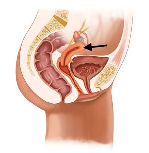 Anatomy Pussy - kocakayaali / thinkstockphotos.com. Vagina