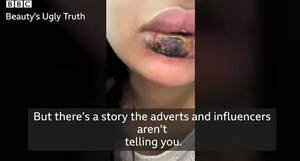 asian teen sucks bbc - Teen dies after doctor sucks out '5 stone' of fat in liposuction op found  online - World News - Mirror Online