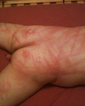 caning marks - Flogging, Caning Marks from Mistress. Bondage Porn Pictures, XXX Photos,  Sex Images #1540795 - PICTOA