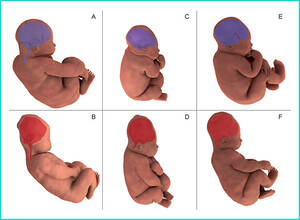 3d Girls Forced To Have Sex - 3D Images Show How Baby's Head Changes Shape During Birth