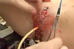 Mutilation Bdsm Porn - 