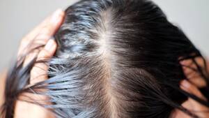 Hair Pulling Forced Sex Porn - What Is 'Scalp Popping'? The TikTok Trend Is Dangerous, Say Docs