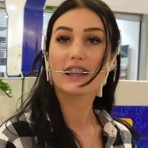 Braces Headgear Porn - headgear braces on Instagram: â€œ#headgearbracesâ€ | Headgear, Braces,  Instagram