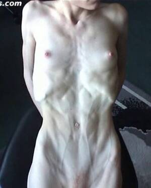 anorexic cindy - anorexic girl Cindy posing naked indoors Porn Pictures, XXX Photos, Sex  Images #2693842 - PICTOA